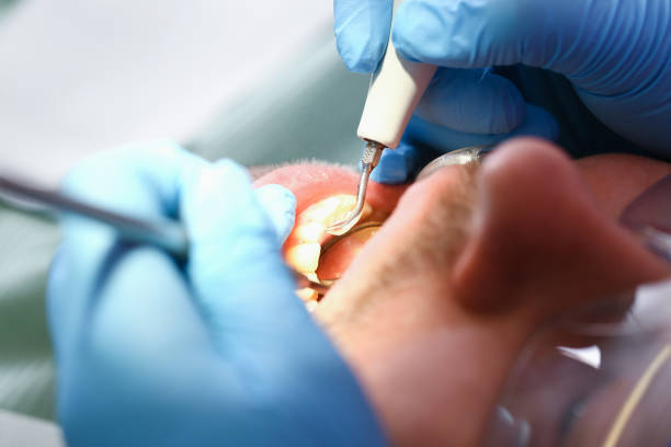 Best Emergency Treatment for Toothache in Cumming, GA