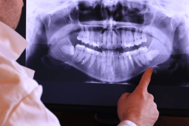 Best Weekend Emergency Dentist in Cumming, GA