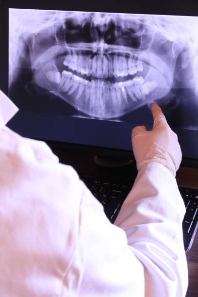 Best Emergency Wisdom Teeth Removal in Cumming, GA