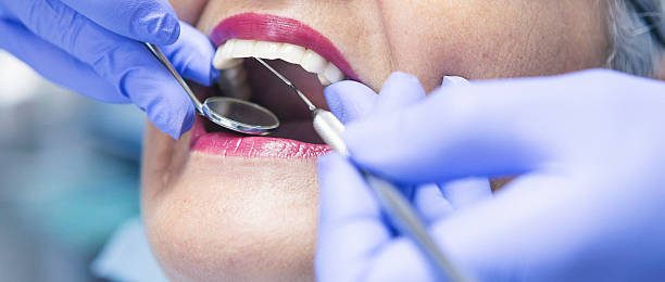 Best Emergency Root Canal Treatment in Cumming, GA